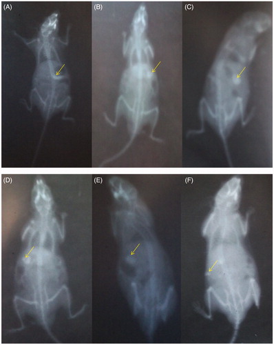 Figure 10. In vivo X-ray radiographic images (A) just after microsphere administration, (B) after 1 h (stomach), (C) and (D) 2 and 3 h (pyloric junction), (E) 4 h (small intestine), (F) 6 h (ileo-cecal junction).