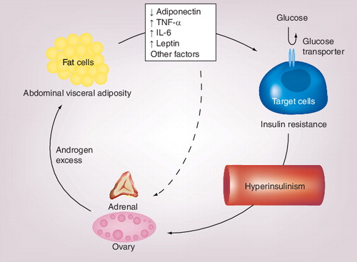 Figure 1. Unifying hypothesis explaining the interplay between the polycystic ovary syndrome and abdominal adiposity.This interplay is the result of a vicious circle represented by the solid arrows: androgen excess favors the abdominal deposition of body fat, and visceral fat facilitates androgen excess of ovarian and/or adrenal origin by the direct effects (dashed arrow) of several autocrine, paracrine and endocrine mediators, or indirectly by the induction of insulin resistance and hyperinsulinism.Reproduced from Citation[6], with permission. © Elsevier (2007).