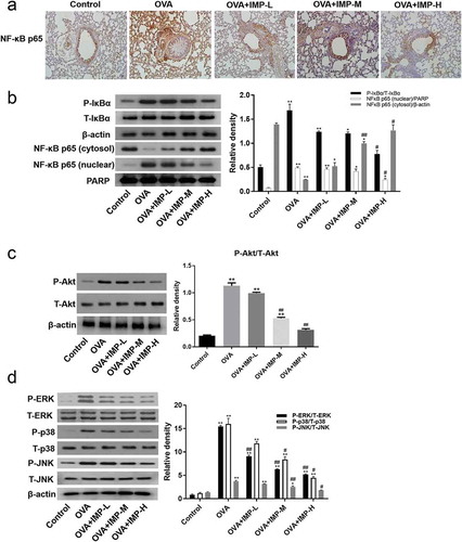 Figure 6. Effect of IMP on the nuclear translocation of NF-κB, phosphorylation of Akt, ERK, p38, and JNK.