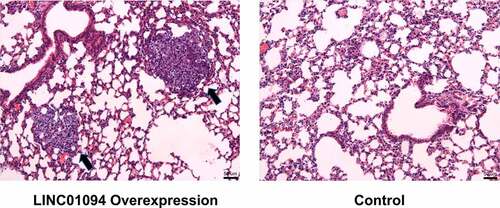 Figure 6. LINC01094 promoted the lung metastasis of MDA-MB-231 cells in vivo.