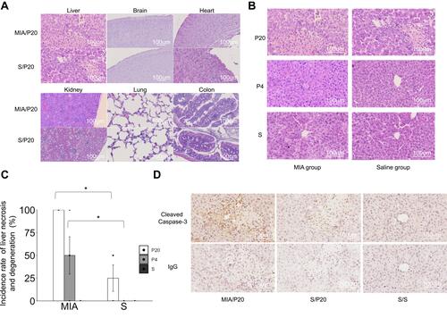 Figure 2 Histological examination of the organs. (A) HE-stained organs of MIA/P20 and S/P20 at 24 h. (B) HE-stained liver at 24 h in the MIA and saline groups. (C) Frequency of liver necrosis at 24 h in MIA and saline groups. (D) Immunostaining of cleaved caspase-3 in the liver at 24 h in MIA/P20, S/P20, and S/S. *p < 0.05, Mann–Whitney U-test. Data are represented by mean ± SE. Number of dams = 4 in each group; number of pups = 8–9 in each group. P20, poly(I:C) 20 mg/kg; P4, poly(I:C) 4 mg/kg; S, saline.