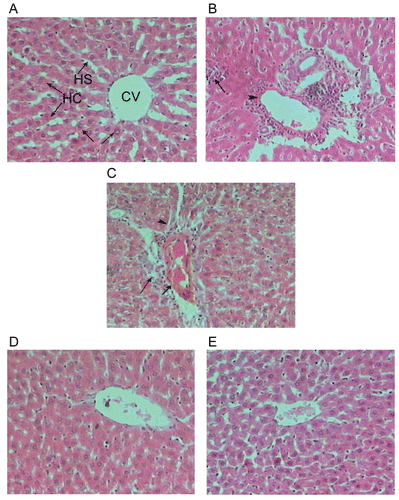 Figure 1.  A photomicrograph of section of liver of (A) control rat showing the architecture of a hepatic lobule, (B) rat liver given an oral dose of paracetamol equivalent to 3 g/kg BW showing focal necrosis associated with inflammatory infiltration. Notice the venous congestion in the portal area, (C) rats given an oral dose of paracetamol equivalent to 3 g/kg BW showing a portal tract with dilated and congested vein. Notice the periportal necrosis of the hepatocytes that surround the portal area, and the inflammatory infiltration, (D) rat daily given an oral dose equivalent to 200 mg/100 g BW of total 70% methanol extract of L. leonurus for seven successive days and treated with a dose of paracetamol equivalent to 3 g/kg BW on day 8 showing the liver architecture that appears more or less as control, and (E) rats daily given an oral dose equivalent to 200 mg/100 g BW of chloroform extract of L. leonurus for seven successive days and treated with a dose of paracetamol equivalent to 3 g/kg BW on day 8 showing the liver architecture that appears more or less as control (H & E stain-X 300).