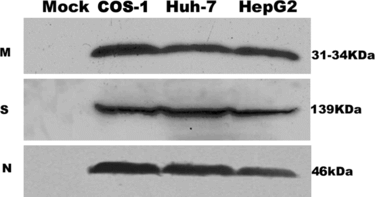 Figure 1 Detection of SARS coronavirus M, S, N protein in COS-1, Huh-7, HepG2 by Western blot analysis. The results are representative of at least three independent experiments. M, N protein is detected in 15% SDS-PAGE gel, S protein is detected in 10% SDS-PAGE gel. In mock (pCDNA 3.1-) transfected cells, no land can be detected in the corresponding site.