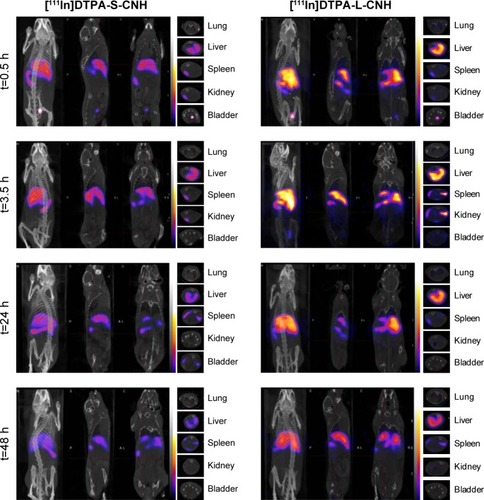 Figure 3 Whole-body SPECT/CT images of 111In-labeled S-CNHs and L-CNHs after intravenous injection in C57BL/6 mice at 0.5, 3.5, 24, and 48 hours (h) postinjection.Notes: The bright areas indicate the accumulation of 111In-labeled S-CNHs and L-CNHs. Images from left to right show whole-body, sagittal, frontal, and transverse views. The transverse cross-sectional images of spleen, liver, lung, kidney, and bladder are shown in the last columns.Abbreviations: DTPA, diethylenetriaminepentaacetic acid; SPECT/CT, single-photon emission computed tomography/computed tomography; CNHs, carbon nanohorns; S-CNHs, small-sized CNHs; L-CNHs, large-sized CNHs.