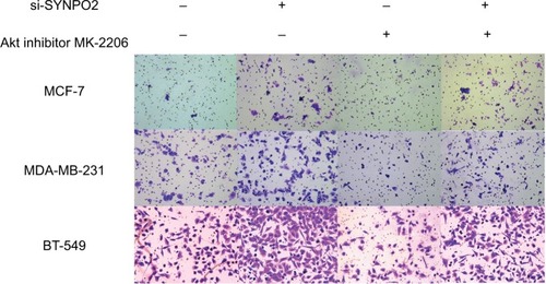 Figure 8 Transfection with Akt inhibitor MK-2206 could partly rescue SYNPO2-mediated invasion.Note: Magnification 20×.Abbreviation: SYNPO2, synaptopodin 2.