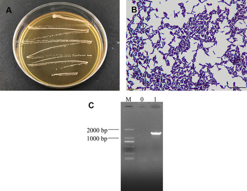 Figure 1 (A) Colony morphology, (B) Gram staining result, and (C) 16S rDNA agarose gel electrophoresis of PCR-amplified product of Lactobacillus fermentum XY18.