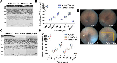 Figure 2 Photoreceptor degeneration was induced by bright light in Rdh12−/− mice. (A) Montage of cross-sections of the retina from Rdh12−/− and Rdh12+/+ mice that raised in 12h dark/12h light conditions for 1 year. (B) Quantify the thickness of different layers in Rdh12−/− and Rdh12+/+ mice retina, which were measured at 1000 µm from the optic nerve head. (C) Montage of cross-sections of the retina from Rdh12−/−, Rdh12−/−-LD and Rdh12+/+-LD mice, which exposed to light for 48 h and then dark-adapted for 24h. The ages of mice were 6–8 weeks. (D) Quantify the thickness of different layers in Rdh12−/−, Rdh12−/−-LD and Rdh12+/+-LD mice retinas, which were measured at 1000 µm from the optic nerve head. (E) Fundus camera detected fundus appearance. Results were presented as median (min - max). Scale bar, 20 µm. n=8–12 per group. *P < 0.05 vs Rdh12−/− group. #P < 0.05; ##P < 0.01 vs Rdh12−/−-LD group.