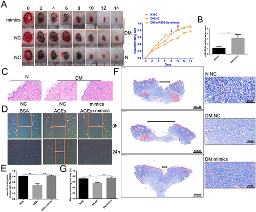 Figure 3 MiR-185-5p mimics accelerated diabetic wound healing through increasing reepithelization. (A) Representative wound images taken on specific days of the experiment, the rate of wound closure on specific days of the experiment as indicated. N = 8 rats per group; *P < 0.05, DM miR-185-5p mimics vs DM NC; #P < 0.05, ##P < 0.01, DM NC vs N NC. (B) The miR-185-5p mRNA levels were determined with qRT-PCR, and miR-185-5p levels were significantly increased in the wound of diabetic rats when direct delivery of the miR-185-5p mimics. N = 3, *P < 0.05. Normalized data are shown as mean ± SD. (C) Representative images of HE staining of wound tissues (100 × magnification). (D and E) Migration of human skin fibroblasts transfected with miR-185-5p mimics and mimic-NC under HG (33.0 mM) conditions were assessed by wound healing assay (n = 3). A 100 × microscope captured the photos, and the statistics were performed by Image J (n = 3, **P < 0.01). (F) Representative images of Masson staining of wound tissues (scale bar = 500uM and 20uM; the blue color represents collagen; n = 3). (G) Wound tissue collagen fiber quantification using Image J (Means ± SEM, n = 3, **P < 0.01).