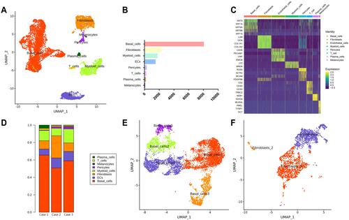 Figure 1 Identification of cell types in odontogenic keratocyst (OKC) tissue samples. (A) UMAP plot of single cells profiled in the presenting work colored by major cell types (basal cells, fibroblasts, myeloid cells, endothelial cells, T cells, plasma cells, pericytes and melanocytes); (B) Cell number of major cell types in OKC; (C) Heatmap of the top expressed genes in major cell types. (D) Proportion of major cell types in 3 patients with OKC (cases 1, 2, and 3). (E) Re-clustering of basal cells (KRT5+) into 5 subtypes represented by UMAP plot. (F) Re-clustering of fibroblasts (LUM+) into 3 subtypes represented by UMAP plot.