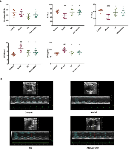 Figure 4 Effect of Qianshan Huoxue Gao (QS) on cardiac function in acute coronary syndrome (ACS) model rats. (A) Echocardiogram data. (B) Photos of the echocardiogram. ##P<0.01, ###P<0.001 compared with the control group; *P< 0.05 compared with the model group.