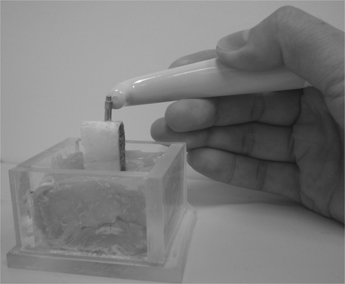 Figure 1. Experimental measurement set-up for dental implant–bovine bone structure. The rib bone with a dental implant is inserted into a resin block. An aluminium rod is screwed into the implant and excited by an electromagnetic pulse from the measurement probe.