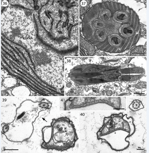 Figs 36–41. Transmission electron microscopy showing details of Nematodinium parvum.