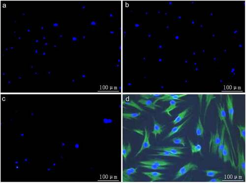 Figure 1. Immunocytochemical staining. A: Negatively stained hBMMSCs for blank control; B: negatively stained hBMMSCs for negative control; C: negatively stained hBMMSCs for CD34; D: positively stained hBMMSCs for CD44.