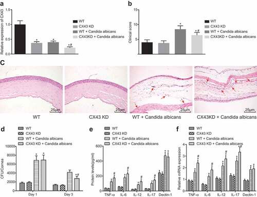 Figure 5. The symptoms of fungal keratitis are alleviated after CX43 knockdown. (a), The expression of CX43 in mouse vascular endothelial cells determined by RT-qPCR; (b), Comparison of clinical scoring in each group; (c), Mice morphological characteristics of corneal tissues in three groups (× 400) with black arrows indicating corneal stromal fibers and red arrows indicating inflammatory cells; (d), Fungal load capacity in infected cornea of each group; (e), Relative mRNA level of each gene in corneal tissues of each group; (f), Protein levels of each gene in corneal tissues of each group; *, p < 0.05 vs. the WT group; #, p < 0.05 vs. the WT + Candida albicans group; HE, hematoxylin-eosin; TNF, tumor necrosis factor; CX43, connexin43; IL, interleukin; n = 12; all data were measurement data, expressed as mean ± standard deviation and analyzed by one-way analysis of variance; the experiment was repeated for three times.