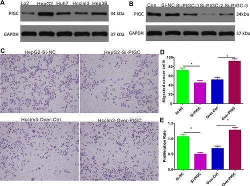 Figure 7 Expression of PIGC and effects of PIGC on proliferation and migration in liver cancer cell lines. (A) Expression of PIGC protein is higher in liver cancer cell lines than in normal liver cell line. (B) Si-PIGC-2 is the most efficient Si-RNA revealed by Western blot. (C) PIGC contributes to the migration of cancerous liver cells. (D) Quantitative analysis of migrated cells in four groups. (E) PIGC contributes to the proliferation of cancerous liver cells. *Stands for the P value less than 0.05.