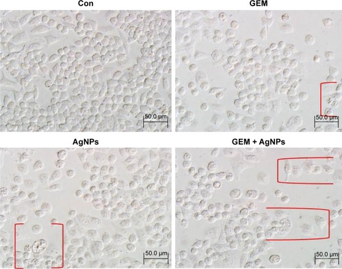 Figure 4 The effect of single treatment with GEM or AgNPs, or the combination of GEM and AgNPs, on cell morphology of human ovarian cancer cells.Notes: The human ovarian cancer cells were incubated with GEM (50 nM), AgNPs (50 nM), or the combination of GEM (50 nM) and AgNPs (50 nM), for 24 h. Treated cells were imaged under a light microscope (200 μm). Red parentheses indicate cell shrinkage and fragmentation.Abbreviations: AgNP, silver nanoparticle; Con, control; GEM, gemcitabine.