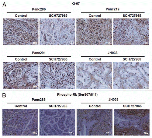 Figure 5 Surrogate biomarker of growth retardation in pancreatic cancer xenografts treated with SCH727965. (A) Tissue specimens from xenografts that showed most vs. least pronounced growth retardation upon treatment with SCH727965 in vivo were stained for Ki67 expression by immunohistochemistry. The figure shows representative sections of mock-treated controls and SCH727965-treated xenografts for each case. (B) Phospho-Rb(Ser807/811) staining of xenograft tissue specimens by IHC at cessation of treatment.