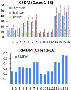 Fig. 6. Parameter study results. CSDM (DAI risk indicator) for the forebrain (solid bars), the brainstem (dashed bars), and the relative difference between them (striped bars) (top). Maximum average RMDM (ASDH risk indicator) values (bottom).