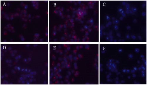Figure 2. Uptake of Rhodamine-L-FP21, and Rhodamine-D-FP21 by HO8910 cells and 293T cell. Images A,B are fluorescence images of uptake of Rhodamine-L-FP21, and Rhodamine-D-FP21 by HO8910 cells after 4-h incubation, respectively. Images D,E are fluorescence images of uptake of Rhodamine-L-FP21, and Rhodamine-D-FP21 by HO8910 cells after 12-h incubation, respectively. Images C,F are fluorescence images of uptake of Rhodamine-L-FP21 and Rhodamine-D-FP21 by 293T cells after 4-h incubation, respectively: red represents red fluorescence protein expressed by Rhodamine; DAPI represents cell nuclei stained with DAPI. Original magnification, 200×.