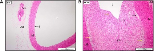 Figure 23 Photomicrographs of aorta of CN (A) and HCD (B) groups.