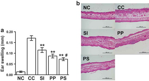 Figure 1. Dietary pomegranate polyphenol (PP) and soy isoflavone (SI) attenuate ear swelling and edema in contact hypersensitivity (CHS) mice.(a) Ear swelling. NC, non-CHS control group; CC, CHS control group; SI, SI-treated group; PP, PP-treated group; PS, PP and SI-treated group. The data are presented as the means ± SEM of the data from two independent experiments [n = 6 mice per group, except for the non-CHS group (n = 3)]; **p < 0.01 vs. CC, #p < 0.05 PS vs. SI. (b) Hematoxylin and eosin-stained images of auricle tissues. Scale bars, 500 μm.