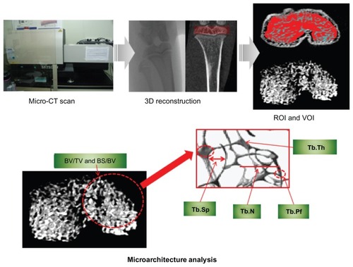 Figure 1 Micro-computed tomography (μ-CT) scan, 3-D reconstruction, region of interest (ROI) and volume of interest (VOI) selection, and bone microarchitecture analysis in 3-D trabecular bone.