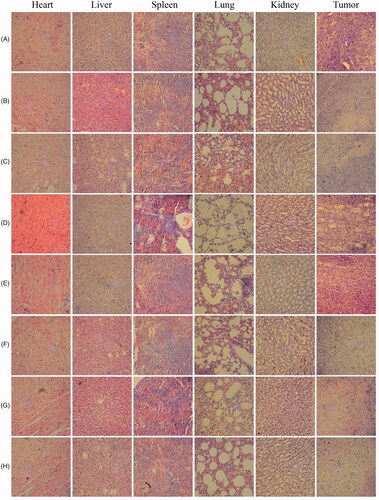 Figure 6. Hematoxylin and eosin staining of heart, liver, spleen, lung, kidney and tumor sections in mice. (A) Control; (B) control + laser; (C) SWCNT; (D) SWCNT + Laser; (E) curcumin; (F) curcumin + Laser; (G) SWCNT-Cur; (H) SWCNT-Cur + Laser.