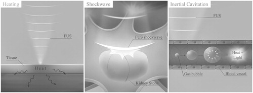 Figure 1. Illustration of different treatment types. From left to right: thermal, shockwave and cavitation-mediated. (Courtesy of H. Lin).