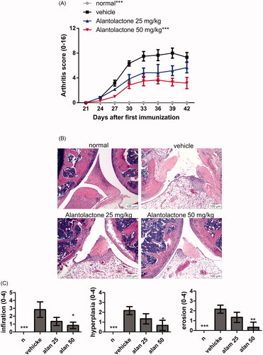 Figure 5. Alantolactone ameliorated the severity of CIA in mice. Beginning the day after the booster immunization, alantolactone (25 and 50 mg/kg) or vehicle (10% DMSO and 90% glyceryl trioctanoate) was administered orally once daily from day 21 to day 42. (A) Arthritis scores were monitored every three days after the immunization booster. Data are representative of three independent experiments, and values are expressed as the mean ± SEM (n = 6 per group). ***p < 0.001 versus vehicle-treated CIA control mice calculated with two-way ANOVA. (B) Histopathology of arthritic joints of alantolactone-treated and vehicle-treated mice by H&E staining of representative sections and (C) by histology scores at day 42 postimmunization (original magnification ×100). *p < 0.05, **p < 0.01, ***p < 0.001, versus the CIA vehicle group, as determined by one-way ANOVA with Dunnett’s test.