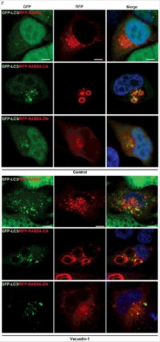Figure 4E. Expression of RAB5A-CA enhanced vacuolin-1 induced autophagy arrest, whereas expression of RAB5A-DN blocked it in HeLa cells.