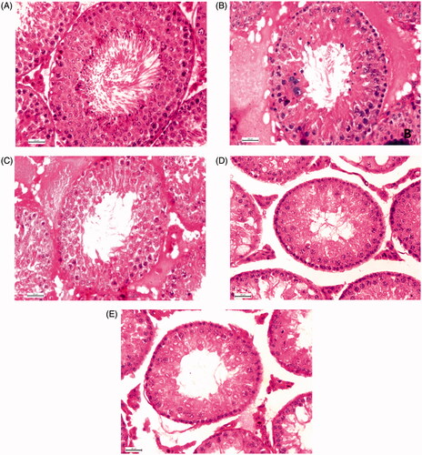 Figure 3. Histology of testis 400 X (Hematoxylin Eosin Stain). Representative microphotographs of a vehicle control (A), T. chebula (B), M. balbisiana (C), ‘Contracept-TM’ (D) and CPA (E) treated rat. Vehicle control group rat showed normal spermatogenesis at stage VII and STD. Different individual extract, ‘Contracept-TM’ and CPA-treated groups showed significant decrease in the number of different generations of germ cells at stage VII and STD in respect to the vehicle control group (p < 0.05).