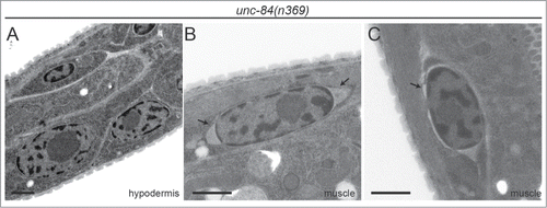 Figure 2. UNC-84 is required for even nuclear envelope spacing only in body wall muscle cells. (A) Hypodermal larval nuclei in the unc-84(n369) animal do not display blebbing of the nuclear envelope. (B-C) However, large distortions of the nuclear envelope were observed at the ends of body wall muscle nuclei (arrows in B) and occasionally, along the sides (arrow in C). Scale bars are 1μm.