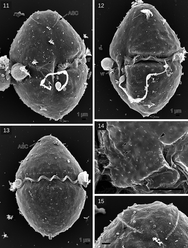 Figs 11–15. Gymnodinium baicalense, SEM. Fig. 11. Ventral view, ASC: apical structure complex, lf: longitudinal flagellum, tf: transverse flagellum, vr: ventral ridge; Fig. 12. left lateral view; Fig. 13. Dorsal view; Fig. 14. Polygonal amphiesmal vesicles (arrows), sulcal extension (arrowhead); Fig. 15. Details of the ASC with small knobs of the rib (arrow)