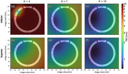 Figure 3. Spatial distribution in TRE computed by EquationEquation (1)(1) TRE(x)2=1Nr(1+13∑k=13dk2fk2)FLE2(1) over a cross section of the phantom for N = 4, 7, and 10 registration fiducials for Inferior/Superior fiducial configurations. Registration fiducial/target locations (magenta/green) are projected onto the cross section. The low TRE magnitude, high degree of spatial uniformity, and similarity in TRE distributions for the N = 10 case supports LOO analysis as a means to obtain 10 TRE estimates in a single QA test with 10 measurement points.