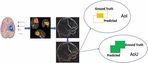 Figure 4. Ground Truth Test for Brain Tumor Detection.