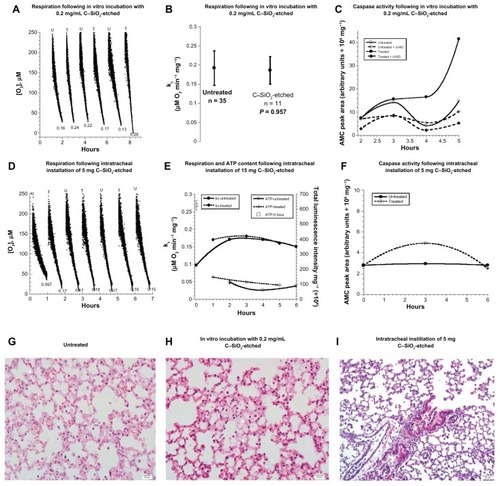 Figure 1 (A–I) Biocompatibility of C–SiO2-etched nanoparticles with lung respiration, adenosine triphosphate (ATP) content, caspase activity, and histology. (A–C) Lung specimens were incubated in vitro at 37°C in oxygenated Krebs–Henseleit (KH) buffer with and without 0.2 mg/dL C–SiO2-etched nanoparticles. Cellular respiration and caspase activity were then measured as a function of time. Representative O2 runs are shown in (A). Samples were alternatively removed from the incubation mixture, rinsed with KH buffer, and immediately placed in the phosphorescence analyzer for O2 measurement. Minute zero corresponds to the addition of the C–SiO2-etched sample. The rate of pneumatocyte mitochondrial O2 consumption (k, μM O2/minute) is set as the negative of the slope of O2 vs t; the values of kc (in μM O2/minute/mg) are shown at the bottom of each run (U, untreated; T, treated). A summary of the values of kc for all experiments is shown in (B). The P-value is for comparison with the untreated condition; “n” is the number of independent measurements. Caspase activity with and without the pancaspase inhibitor zVAD-fmk is shown in (C). (D–F) Lung specimens were collected 60 minutes after intratracheal instillation of 5 mg C–SiO2-etched sample or 150 μL NaCl. The samples were then incubated in vitro at 37°C in oxygenated KH buffer. Cellular respiration, ATP content, and caspase activity (F) were measured as a function of time. Representative O2 runs, values of kc, and cellular ATP (expressed as luminescence intensity mg/106) are shown in (D and E). (G–I) Representative histology (hematoxylin and eosin) at 4 hours for untreated (G, 40×), in vitro-treated (H, 40×), and intratracheally treated (I, 20×) lungs. The untreated lung tissue (G) demonstrated preserved pulmonary architecture with rare apoptotic bodies (arrow) and cytoplasmic vacuolization (arrowhead). The in vitro treatment (H) revealed foci of alveolar wall necrosis necrosis and a few apoptotic bodies. The in vivo treatment (I) revealed preserved pulmonary architecture with focal sloughing of bronchial epithelial cells, intact alveolar wall and intravascular margination of lymphoid cells.