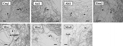 Figure 1  Photomicrographs of the seven Frankia strains used in this study. Arrows and arrowheads indicate sporangia and vesicle-like structures, respectively. Bars are 10 µm.