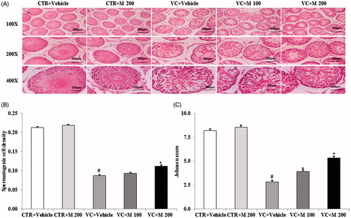 Figure 2. Histologic findings in testis from control groups and varicocele-induced groups. (A) Histological changes in the testis. (B) Spermatogenic cell density. (C) Johnsen’s score of the seminiferous tubules. Original magnifications 100×, 200× and 400×. CTR + vehicle: normal control group; CTR + M 200: normal rats administered 200 mg/kg MOTILIPERM; VC + vehicle: varicocele-induced rats; VC + M 100: varicocele-induced rats administered 100 mg/kg MOTILIPERM; VC + M 200: varicocele-induced rats administered 200 mg/kg MOTILIPERM. #Significantly different from CTR + vehicle group (p < 0.05). *Significantly different from VC + vehicle group (p < 0.05).