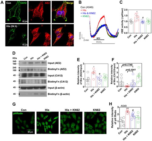 Figure 4. Histamine mediated CA12 and AE2 trafficking through the involvement of calcium-dependent calmodulin kinase II. (A) Immunofluorescence staining of CA12 (green) and AE2 (red) after histamine (His) treatment (100 μM, 24 h) in A549 cells. DAPI (nucleus, blue). (B) CBE activity in response to His treatment (100 μM) with and without KN62 (10 μM) for 24 h in A549 cells. (C) The graph indicates CBE activity in response to His treatment (100 μM) with and without KN62 (10 μM) for 24 h in A549 cells. The bars represent means ± SEM (n = 4 ∼ 5, *p < 0.05 vs Control and #p < 0.05 vs His-treated group). (D) Surface expression of AE2 and CA12 after His (100 μM) with and without KN62 (10 μM) for 24 h in A549 cells. (E) The graph indicates the relative intensity of AE2 normalised by input AE2 and β-actin. The bars represent means ± SEM (n = 5, *p < 0.05 vs Control and #p < 0.05 vs His-treated group). β-actin was used as a loading control. (F) The graph indicates the relative intensity of CA12 normalised by input CA12 and β-actin. The bars represent means ± SEM (n = 6, *p < 0.05 vs Control). β-actin was used as a loading control. (G) pHRodo staining (green) after His treatment (100 μM) with and without KN62 (10 μM) for 24 h in A549 cells. The scale bar represents 50 μm. (H) The graph indicates the relative intensity of pHRodo. The bars present means ± SEM (n = 4 ∼ 6, ***p < 0.001 vs Control and #p < 0.05 vs His-treated group).