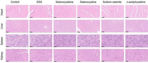 Figure 7 Histological examination of the safety of selenium-containing amino acids. Lung, kidney, heart, liver, and spleen tissues were collected, H&E stained, and analyzed for the safety profile of selenium-containing amino acids. Scale bar is 100 μm.