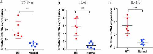 Figure 8. RT-PCR-detected differential expression of IL-β, IL-6 and TNF-α in six un-infected kidneys and six UPEC-infected kidneys in mice. **P < 0.01, ***P < 0.001 using unpaired T-test