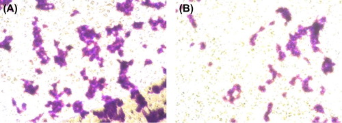 Figure 12. Results of cell invasion assay. (A) Non-transfected cells; (B) Transfected cells.