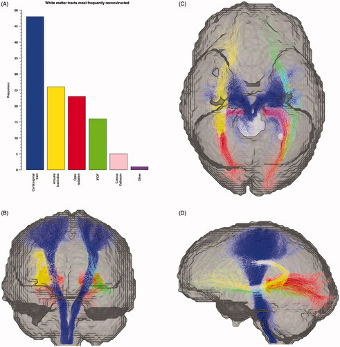 Figure 4. (A) Barplot showing white matter tracts most frequently reconstructed from survey responses. (B) frontal, (C) inferior, and (D) left views of the corticospinal tracts, optic radiations, left inferior fronto-occipital fasciculus and right arcuate fasciculus, coloured according to bars in A (corpus callosum and ‘other’ tractograms not shown for clarity). Tractography reconstructions performed in a healthy volunteer at our institution using constrained spherical deconvolution modelling of multi-shell diffusion MRI data in MRTrix,Citation10 displayed in a ‘glass brain’ mask.