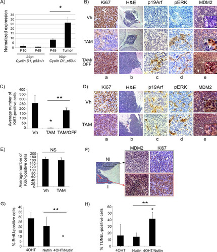 FIG 7 Mdm2 but not p19Arf expression levels correlate with p53 restoration efficacy in pineal tumors. (A) qRT-PCR analysis of mRNA expression levels of p19Arf relative to those of GAPDH in Irbp-Cyclin D1, p53+/+ pineal glands at P10 (proliferating, presenescent) or P49 (senescent) and Irbp-Cyclin D1, p53−/− pineal glands at the pretumorigenic (P49) or tumor (Tumor) stage, as indicated. Each point represents the means from 3 independent experiments. Bars represent standard deviations, and asterisks denote a statistically significant difference (P < 0.05). (B) Representative immunostaining for the indicated proteins and hematoxylin and eosin staining (H&E) in Irbp-Cyclin D1, p53ER(TAM)Ki/− premalignant lesions treated with vehicle (Vh), tamoxifen from P60 to P80 (TAM), and tamoxifen for 10 days from P60 to P70 followed by its withdrawal from P70 to P80 (TAM/OFF). The inset in column e shows a magnified image. (C) Average number of Ki67-positive cells per field under the conditions described for panel B. (D) Representative immunostaining for the indicated proteins and H&E staining in Irbp-Cyclin D1, p53ER(TAM)Ki/− pineal invasive tumors treated with vehicle (Vh) or tamoxifen for 10 days (TAM). The inset in column e shows a magnified image. (E) Average number of Ki67-positive cells per field under the conditions described for panel D. Each point in panels C and E represents the means from at least 4 different mouse pineal sections. Bars represent standard deviations. A single asterisk denotes significance (P < 0.05) relative to corresponding control conditions (Vh), while double asterisks denote significance relative to results for TAM-treated mice, as shown by the horizontal bar. NS denotes nonsignificance. (F) Immunostaining for MDM2 (left) and Ki67 (right) in an Irbp-Cyclin D1, p53ER(TAM)Ki/− pineal lesion in transformation that has both premalignant noninvasive (NI) and invasive (I) tumor components. (G) Percent BrdU-positive cells in explanted Irbp-Cyclin D1, p53ERTAMKi/− pineal tumor cells 7 days after treatment with 4OHT, nutlin, or both, as indicated. (H) Percent TUNEL-positive cells after 24 h of treatment under the same conditions as those for panel G. Each point in panels G and H represents the means from at least 5 different fields. Bars represent standard deviations. A single asterisk denotes significance (P < 0.05) relative to the 4OHT control condition, while double asterisks denote significance relative to the nutlin condition, as shown by the horizontal bar.