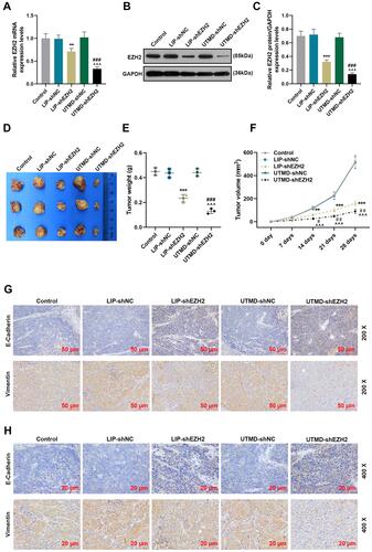 Figure 6 The regulatory effect of UTMD-shEZH2 on the expressions of EZH2, E-Cadherin, and Vimentin and the tumorigenicity of CD133+ HuH7 cells in vivo was stronger than that of LIP-shEZH2. (A) The expression of EZH2 in the tumor tissues of nude mice was detected by RT-qPCR; GAPDH was used as an internal control. (B–C) The expression of EZH2 in the tumor tissues of nude mice was detected by Western blot; GAPDH was used as an internal control. (D) The tumor morphology of nude mice was photographed with a camera. (E) The tumor weights of the nude mice were measured and recorded with an electronic balance. (F) The tumor volume of the nude mice was measured and recorded using a vernier caliper. (G–H) The expressions of E-Cadherin and Vimentin in the tumor tissues of nude mice were detected by immunohistochemical (200× and 400× Magnification). (**P< 0.01, ***P< 0.001, vs LIP-shNC; ^^^P< 0.001, vs UTMD-shNC; #P< 0.05, ##P< 0.01, ###P< 0.001, vs LIP-shEZH2).