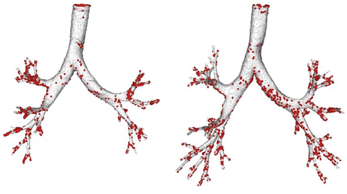 Figure 2. Airway geometry models based on imaging at MLV (left) and TLC (right) for subject H147. Note that the images are at slightly different orientation based on the position of the subject when imaged. Particle deposition results are for 5 µm particles with 30 L/min inhalation flow rate.