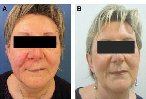 Figure 2 Pre- and post-treatment comparative images.