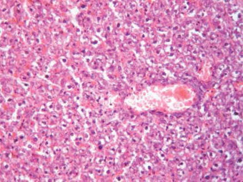 FIGURE B4. Administration of l-arginine showing only mild hydropic degeneration and congested blood vessels (H&E, ×200).