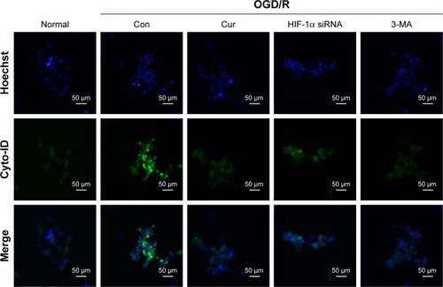 Figure 5 Fluorescence images of autophagic compartments in PC12 cells treated with curcumin, HIF-1α siRNA, or 3-MA (scale bar =50 μm, magnification 400×). The top row shows Hoechst 33342 Nuclear Stain (blue), the middle row shows autophagic compartment stain (green), and the bottom row shows merged images.