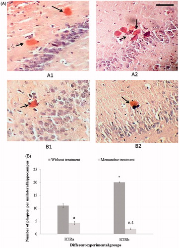 Figure 2. Congo red staining of plaques in hippocampus of experimental rats. (A) Staining of plaques in different rats. [A1] 14-day and [A2] 21-day colchicine-injected. Memantine-treated ICIR in [B1] 14-day and [B2] 21-day study. Magnification = 400×, Bar = 16.18 μm. Arrows indicate plaques. (B) Number of plaques in hippocampus: Plaques were present in the hippocampus of ICIR rats. *Significant increase in number of plaques in ICIR rats in 21- vs 14-day study (p < 0.001). #Significant decrease in memantine-treated ICIR rats in 14- (p < 0.001) and 21-day (p < 0.001) study vs in timepoint counterpart ICIR rats. $Significant decrease in memantine-treated ICIR rats in 21- vs 14-day study (p < 0.05). Abbreviations are as in Figure 1. Values shown are means ± SEM (n = 6/group).